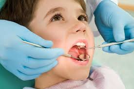 کاربرد چسب متیل متاکریلات در دندانپزشکی